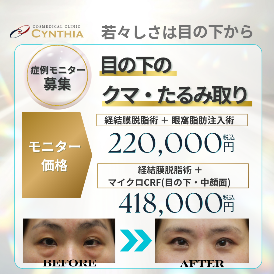 目の下のクマ・たるみ取り