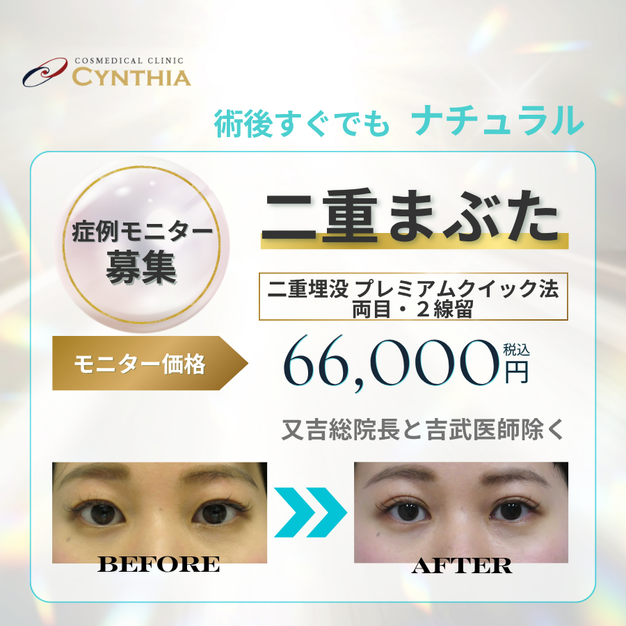 二重まぶた