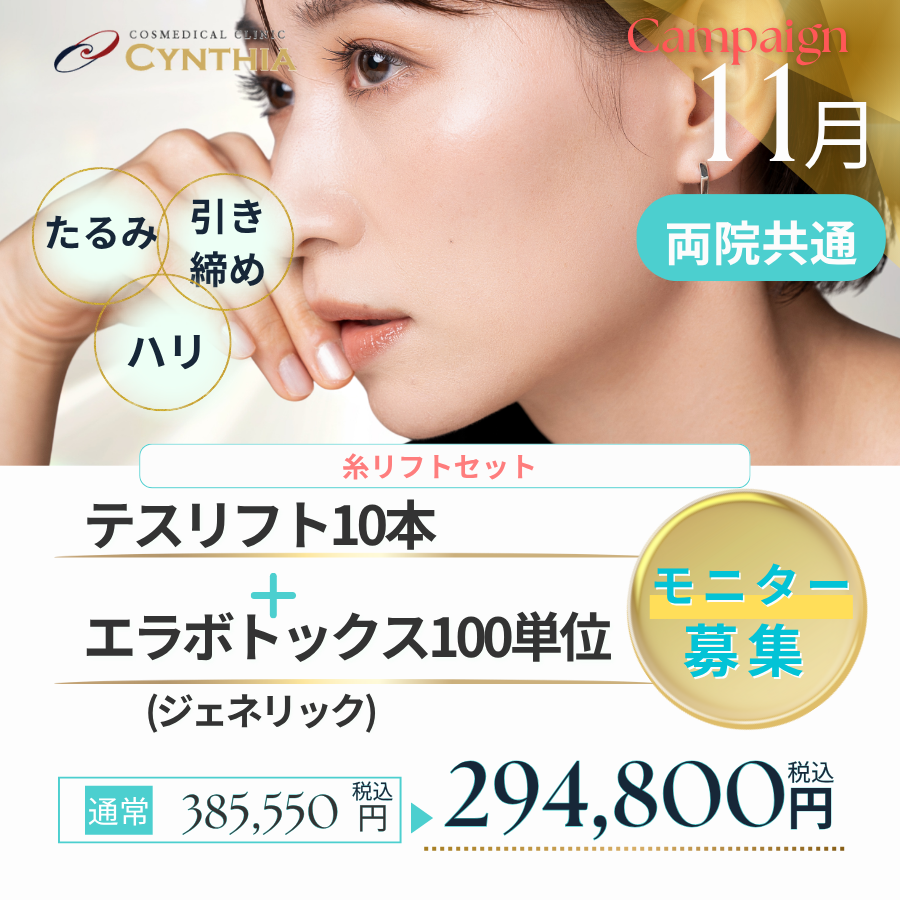 Ncog12本＋ショッピングリフト50本