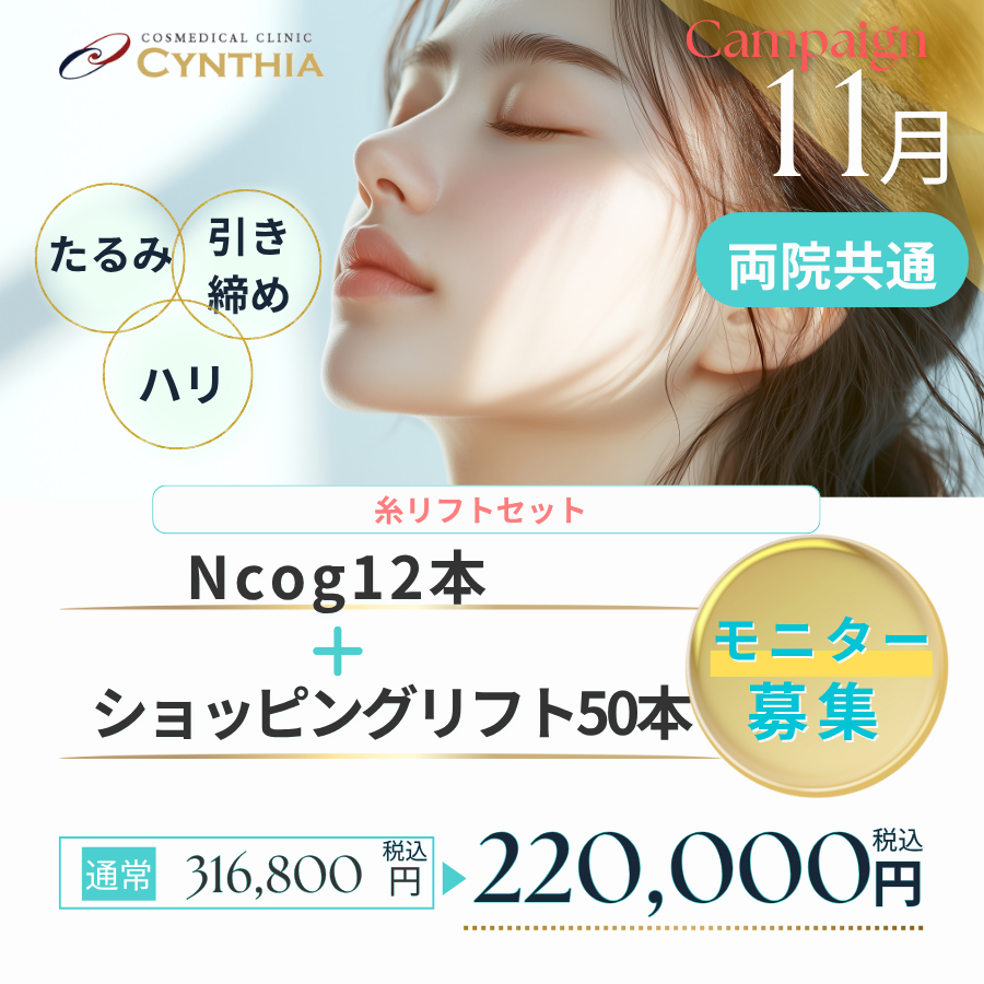 Ncog12本＋ショッピングリフト50本